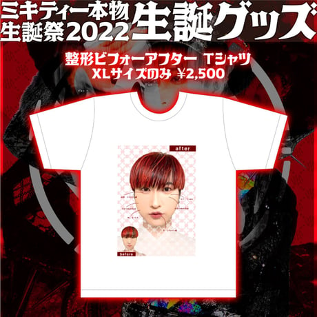 整形ビフォーアフター Tシャツ[ミキティー本物生誕祭2022記念グッズ]