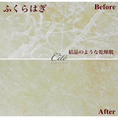 Cité Deep essence cream シーテディープエッセンスクリーム
