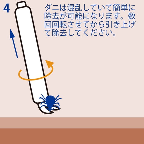 オーベックス ／ エレクティック