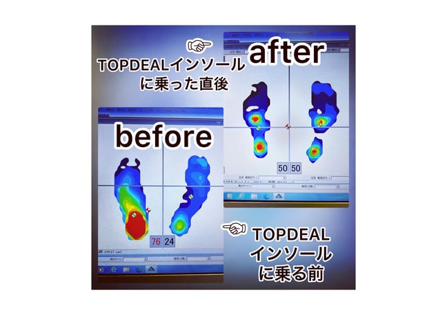 nanoPDS EXOSOME ヘアフィラー 2本セット nanoPDS EXOSOMEヘア