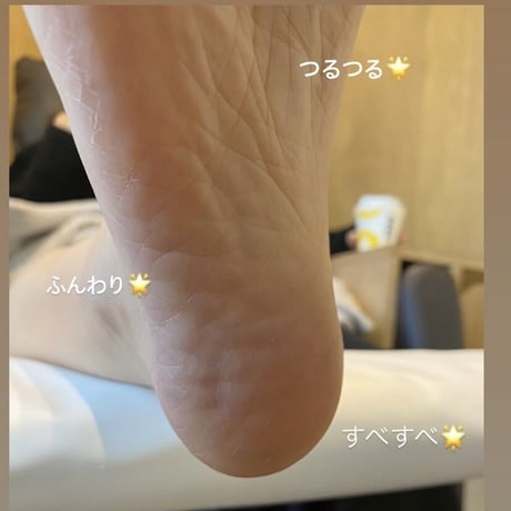 つるつるかかとセット