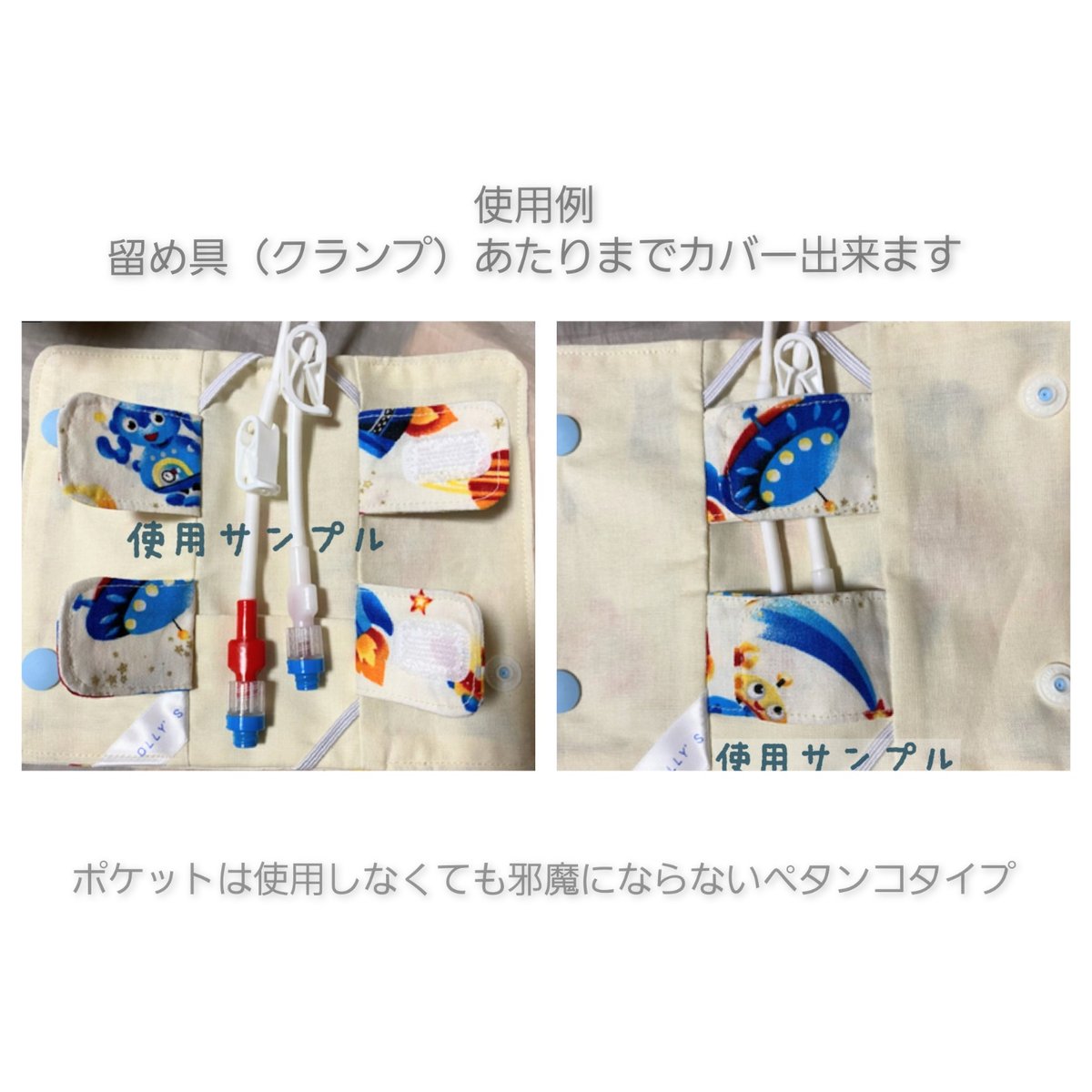 OLLY'S 電車cv点滴カテーテル固定保護カバー | OLLY'S