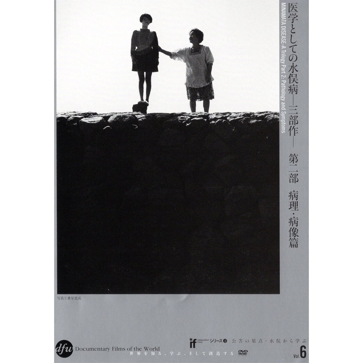 医学としての水俣病 第2部＝病理・病像篇【DVD：個人視聴用
