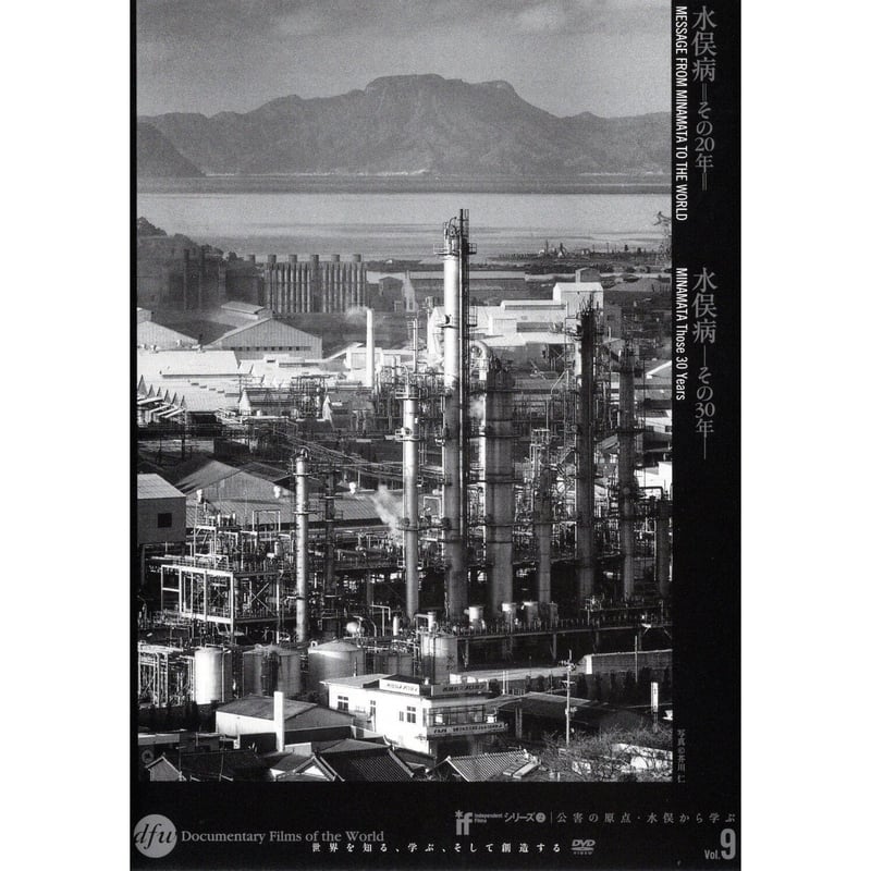水俣病－その20年－／水俣病－その30年－【DVD：個人視聴用