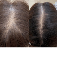 Special Hair Treatment Course