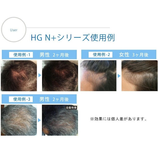 ハーグ ( HARG ) 薬用HGドクターズヘアケアシリーズ HG MD