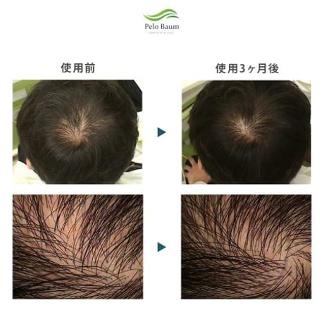 ペロバーム：ヘアケア３点セット