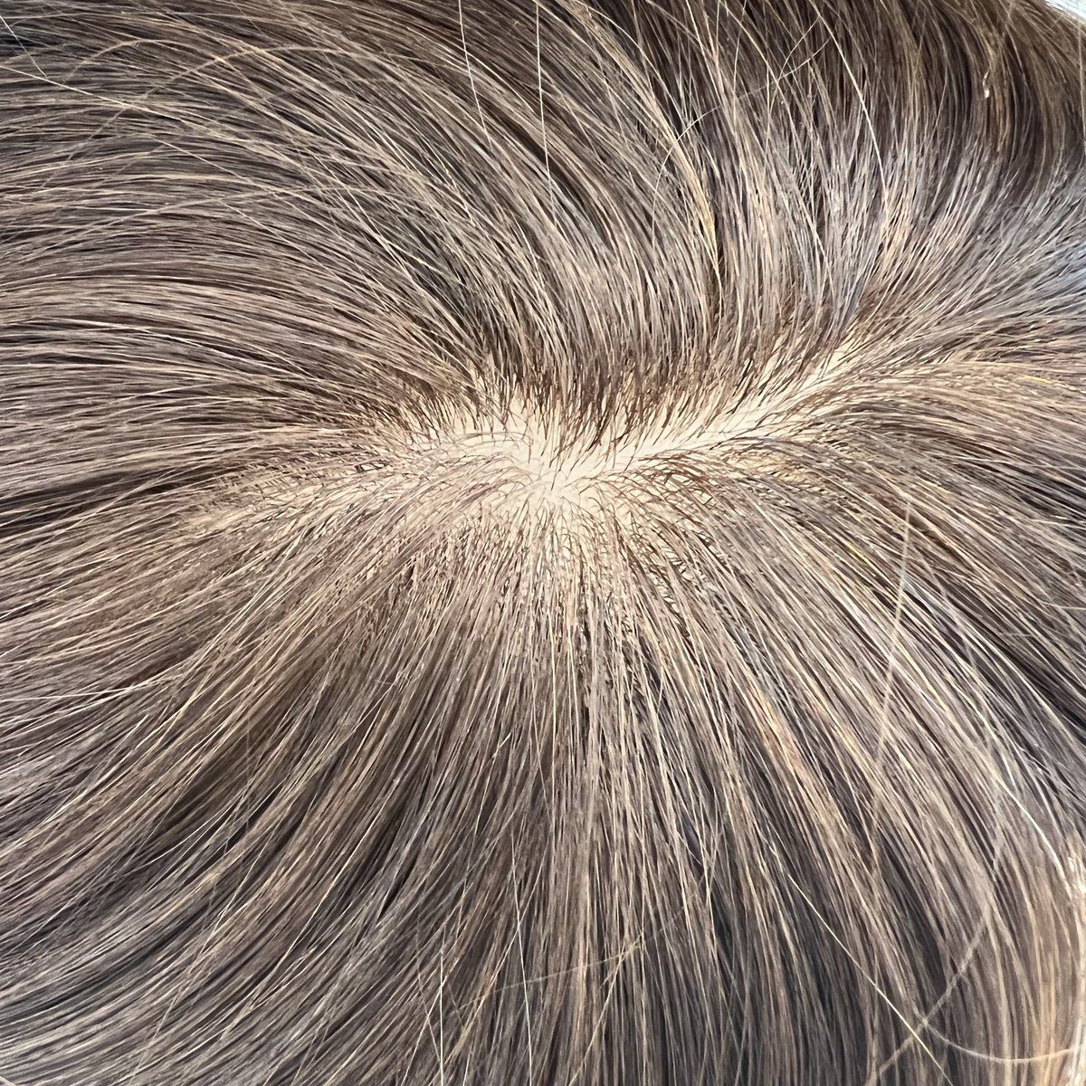 バレないシリーズ前髪は縁まで植毛★新世界ヘアピース12*14総手植え45㌢〜 バレないシリーズ前髪は縁まで植毛☆新世界ヘアピース12*14総
