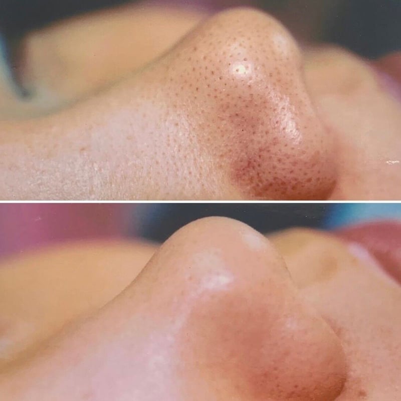 アクアフューチャースキン・シャンパンゴールド | AQUA