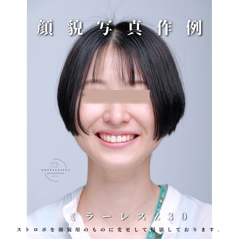 口腔内写真セット ミラーレス｜Nikon Z30リングストロボ仕様 | Dental