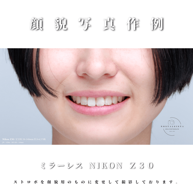 口腔内写真セット ミラーレス｜Nikon Z30リングストロボ仕様 | Dental