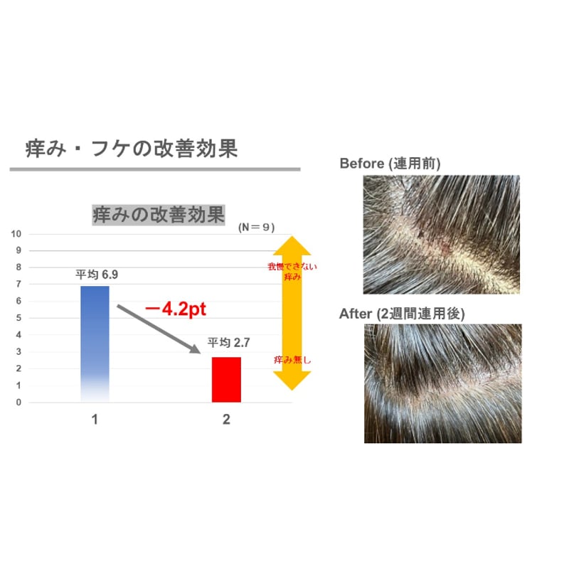 ミュースキャルプ シャンプー フォーカスケア［280ml］ | CHELIN 公式