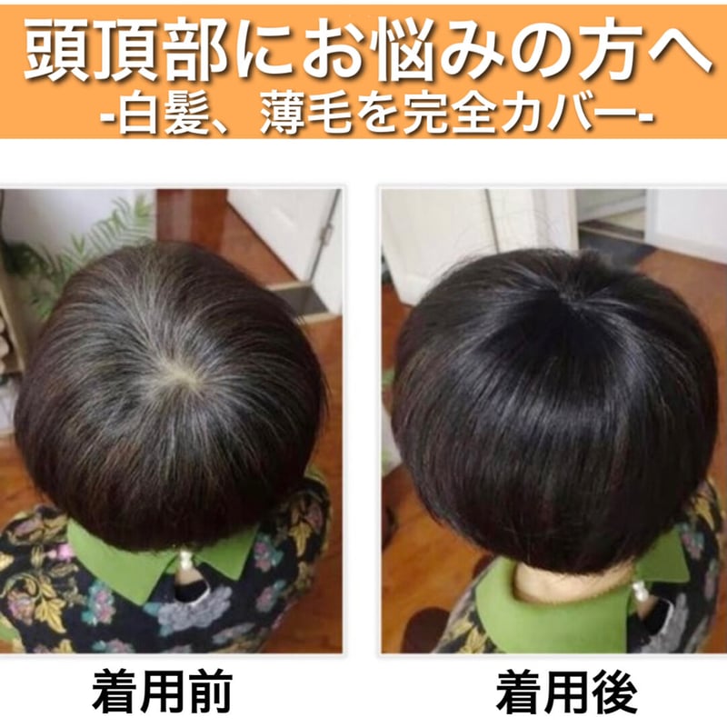 【自然な見た目！高品質メンズ部分カツラ】 楽天市場】メンズ 部分ウィッグ 薄毛対策 自然増毛 薄毛隠し