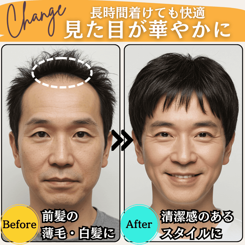 ウィッグ メンズ 人毛100% フルウィッグ 男性 ショート 男性用ウィッグイケ ウィッグ メンズ 人毛100% フルウィッグ カツラ 男性用 ショート 医療