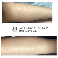 手荒れ肌荒れにエフェクトクリーム６０ｇ（持ち歩き用ミニ付）