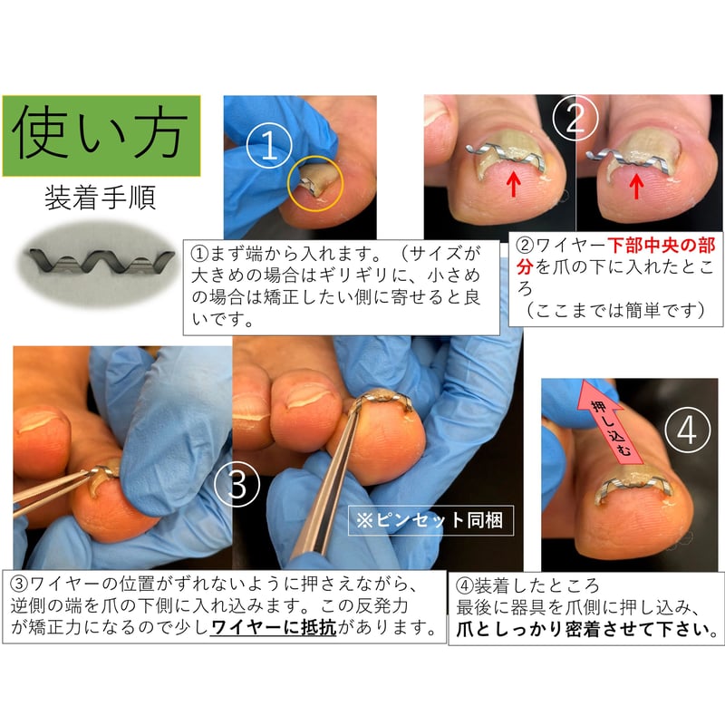 ネイルエイド　16mm　巻爪矯正　説明書付き