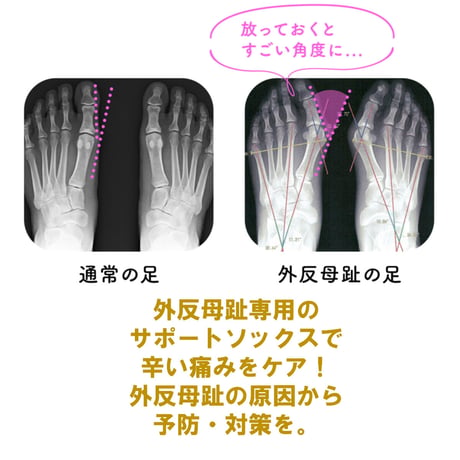 Tabio 外反母趾サポートソックス  22-24cm