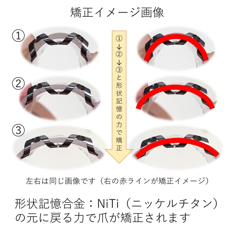 ネイルエイド　16mm　巻爪矯正　説明書付き