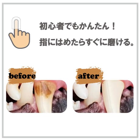 ペットキン ピーナッツバター味 フィンガーティップワイプ  歯用 指にはめて使う 使いやすい マイクロファイバーウェットシート 50枚入り petkin