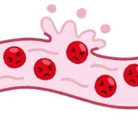 慢性硬膜下血腫の病態関連図