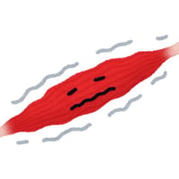 ギランバレー症候群の病態関連図