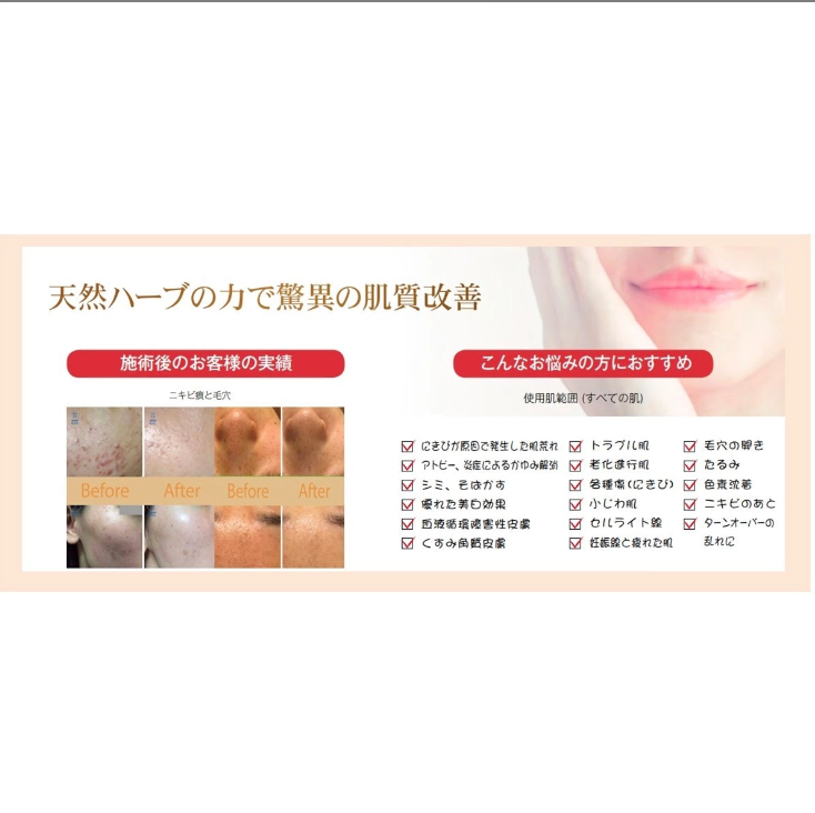 AMAROSアマロスOHLハーブピーリングセット 楽天市場】【 AMAROS JAPAN公式 】アマロス OHLハーブピーリング