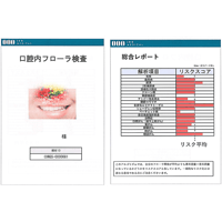 口腔内フローラ検査(オンラインカウンセリング付)