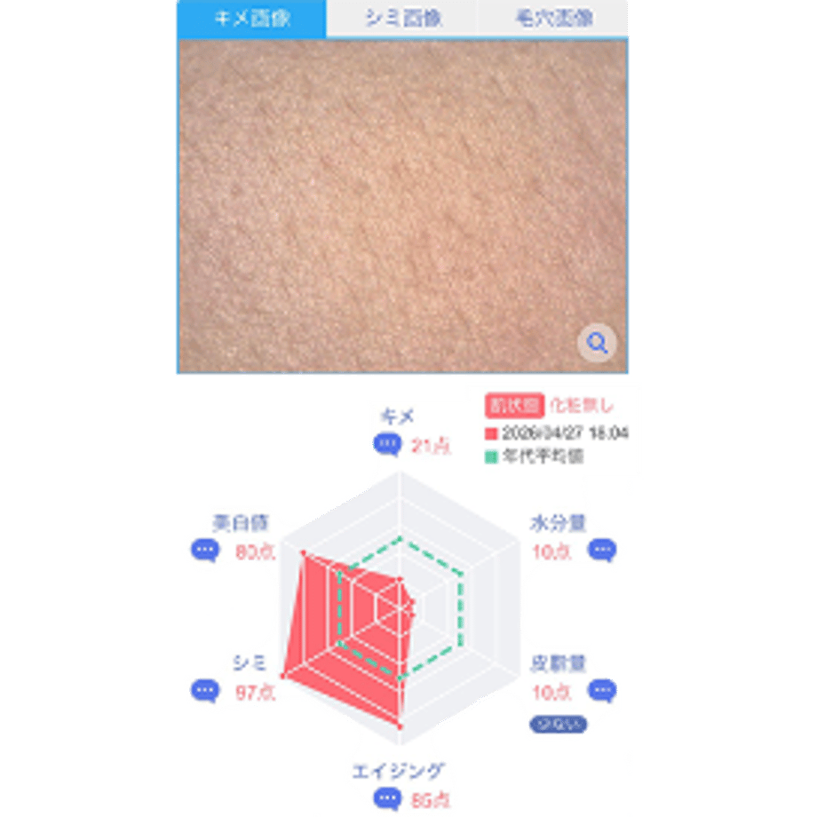 6a1903092987f615fbefe5c4