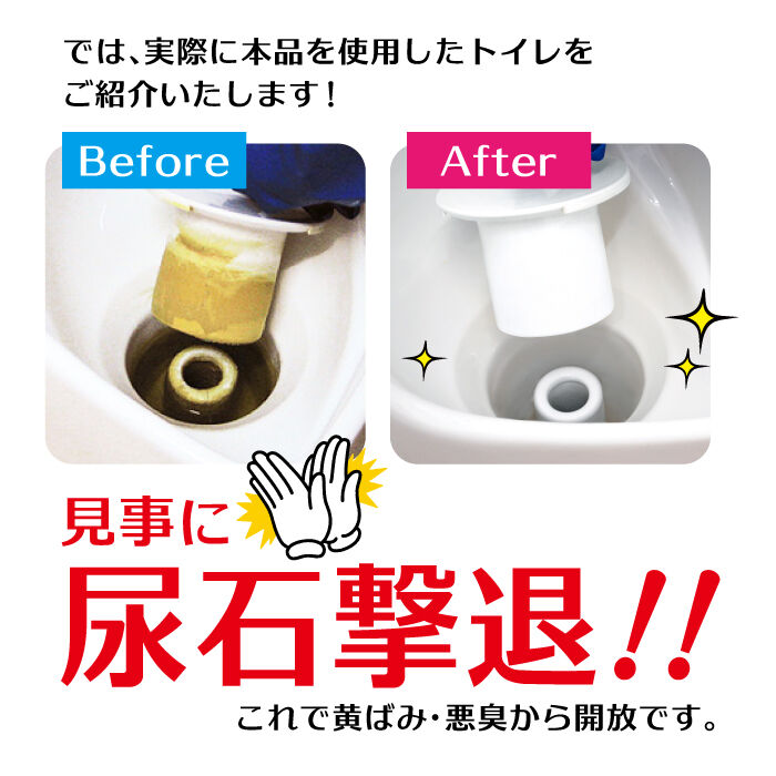 尿石除去剤 強力 尿石おとし 業務用 尿石落としバブル TU-78A