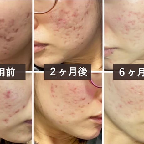 ［美容液］ビューティエッセンスコンセントレイト(60ml)