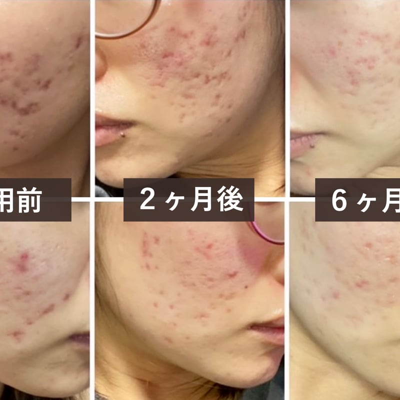 美容液］ビューティエッセンスコンセントレイト(60ml) | Naturale Store