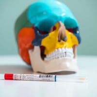 遺伝子検査