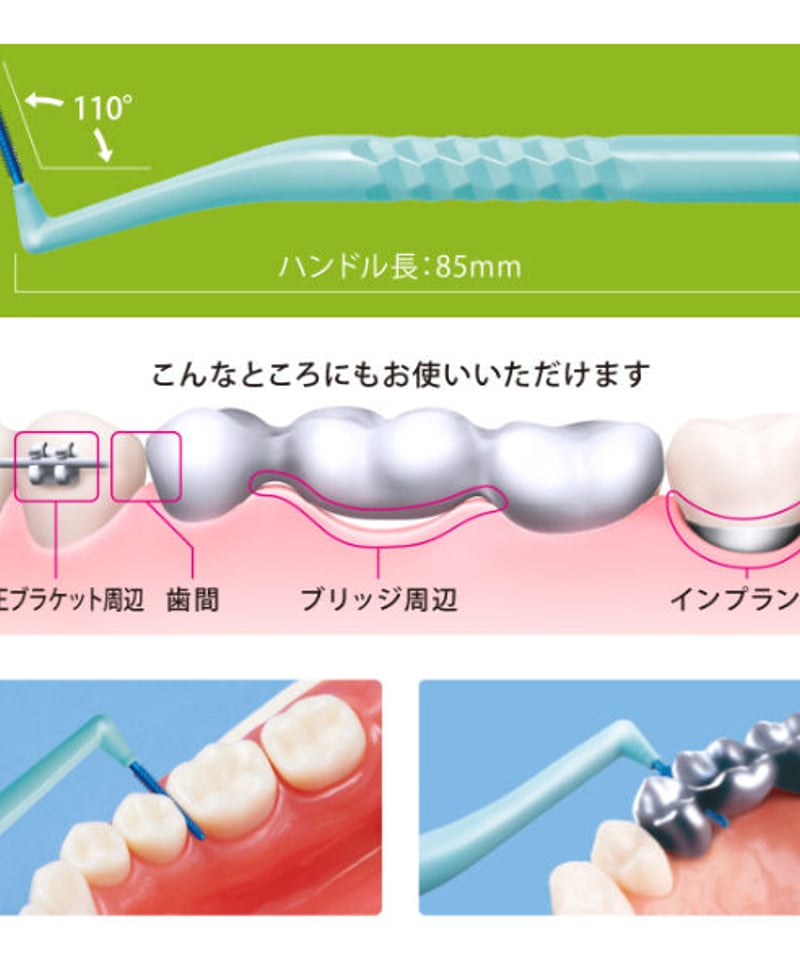 歯間ブラシ DFA0125B0120_l_a001.jpg