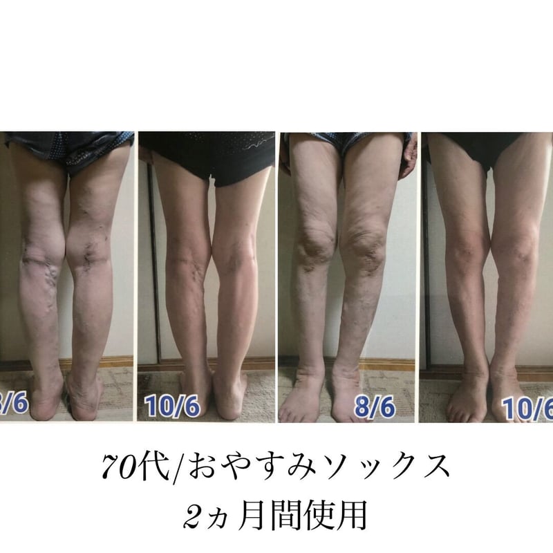 足やせ/むくみ】おやすみソックス（2足組計4 本） | Finest Shop