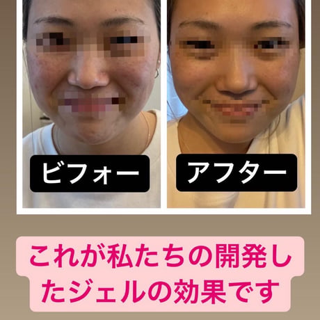 Baobab オールインワンジェル