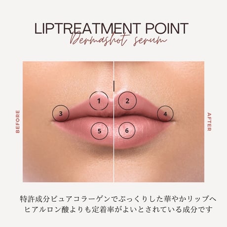 【即日発送】ダーマショットセラム正規取扱店