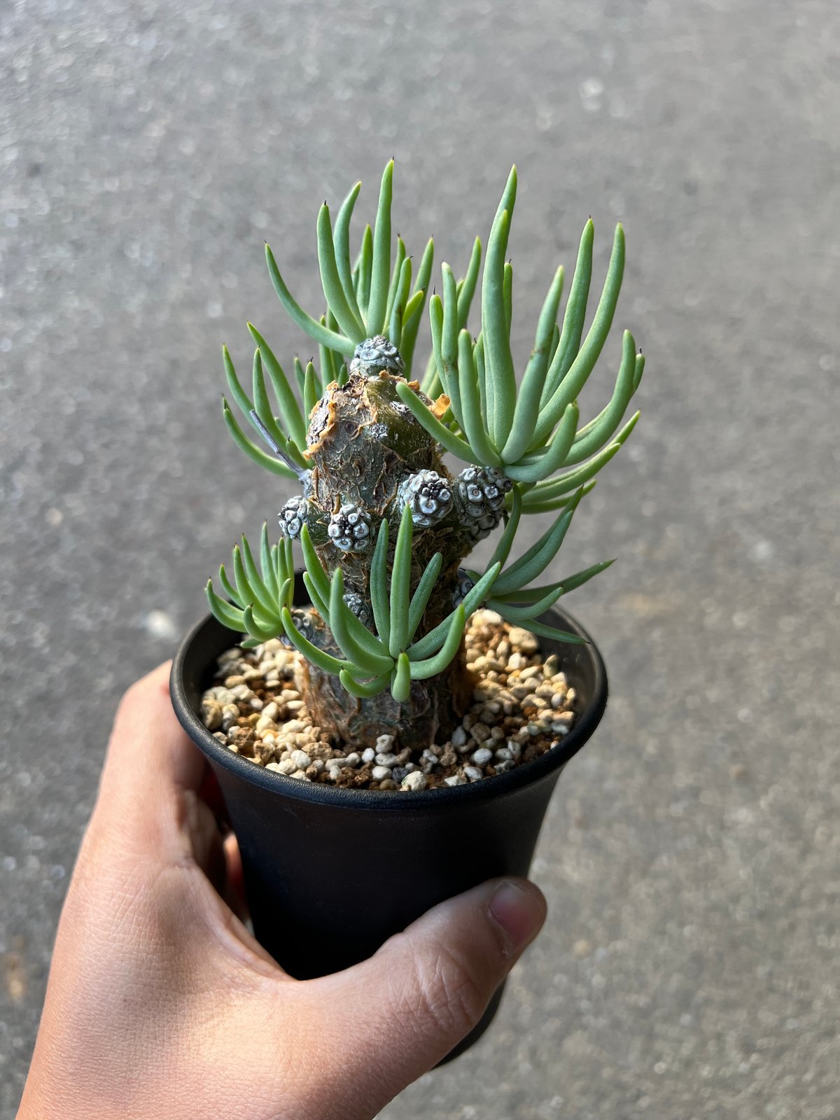 ①ペアルソニー チレコドン ペアルソニー 【公式通販】