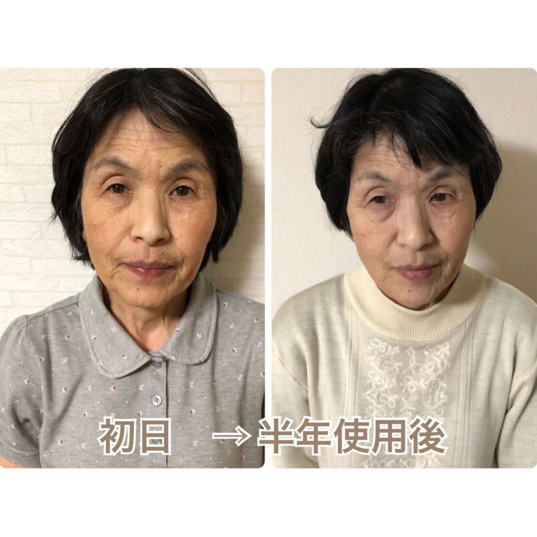 美容液リッチリフト全身美容液100g 新品未使用 - 美容液