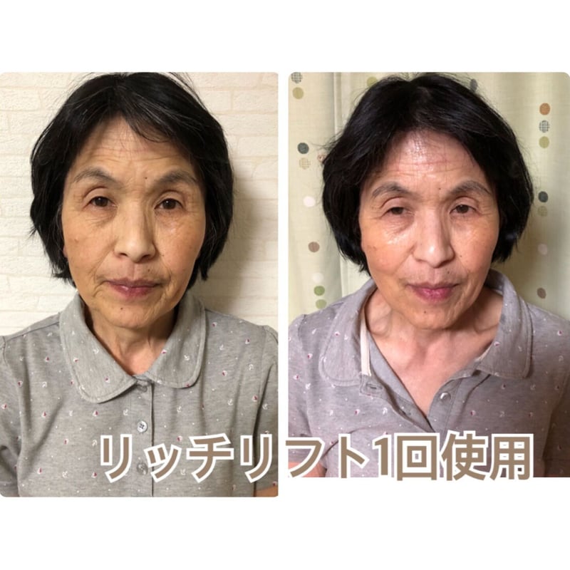 しわ・たるみ改善】リッチリフト 高機能オールインワン 100g