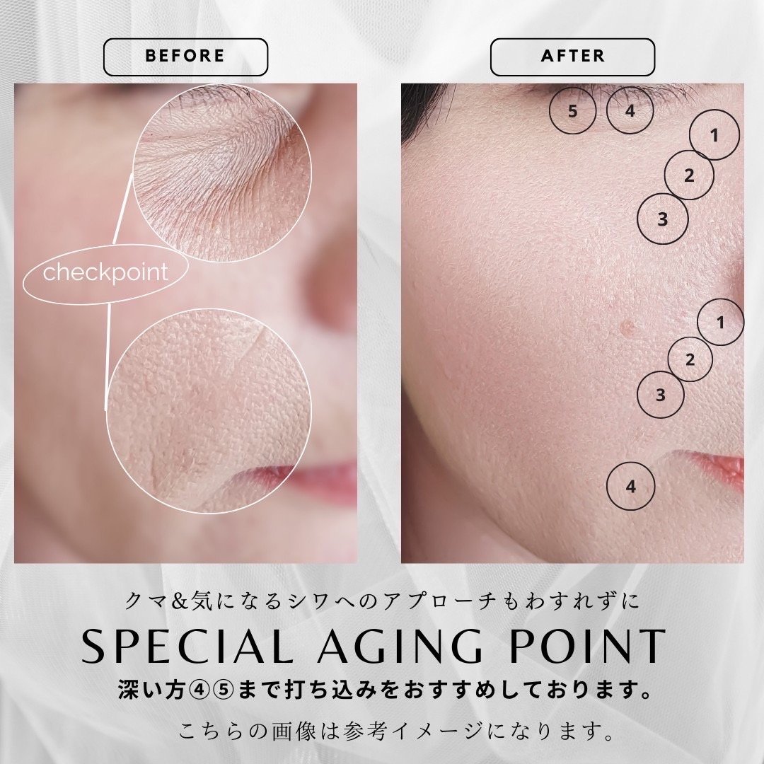 セルフ整形/注入するCysay因子💫ダーマショットセラム | ViDA セルフ整形/注入するCysay因子💫ダーマショットセラム | ViDA