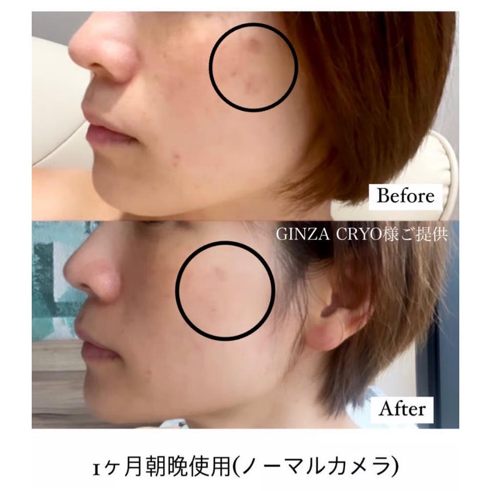 セルフ整形/注入するCysay因子💫ダーマショットセラム | ViDA セルフ整形/注入するCysay因子💫ダーマショットセラム | ViDA
