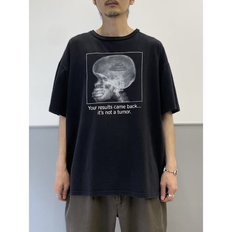 2000's X-ray printed Tee