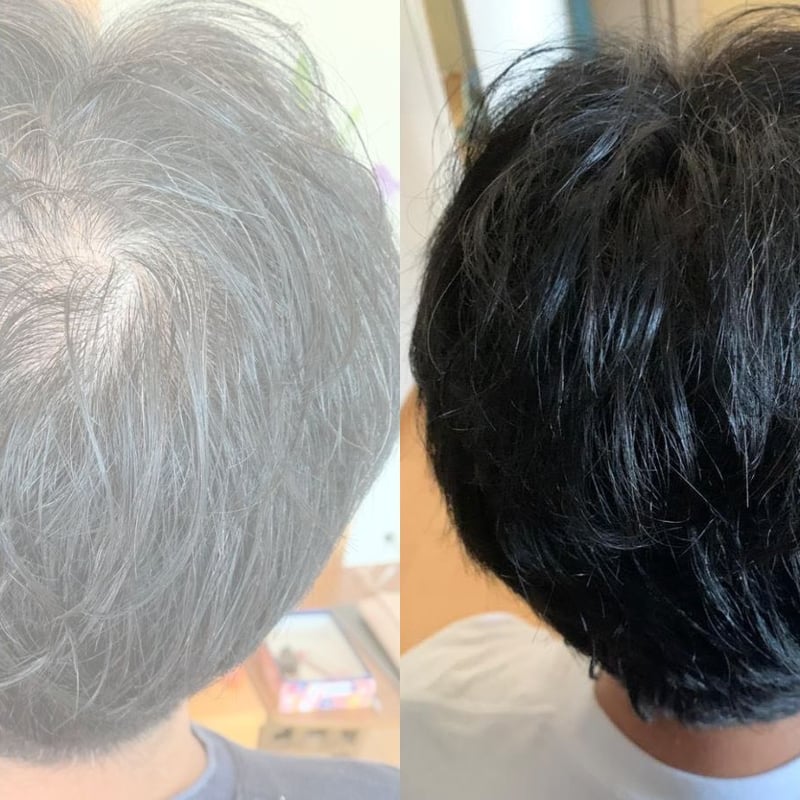 再生医療認定医が監修 幹細胞入り頭皮美容液とフリーズドライパウダー