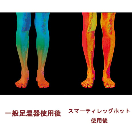 スマーティレッグホット 遠赤外線脚温器 フットバス 水・お湯不要 寒さ 脚冷え対策 6300069186●フジカ【取寄せ商品】