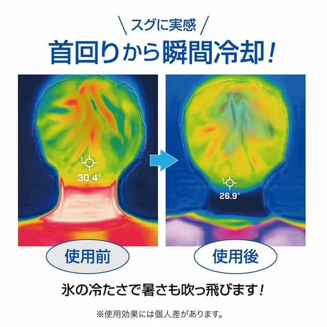 Ｕ－ＣＯＯＬ（ユークール）　ハンズフリーアイスパック　ブルー リンクサス【取寄せ商品】