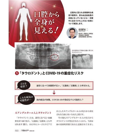 月刊アポロニア21【2023年2月号】医院運営・3つの盲点 ー個別指導、痛みの診断、多職種連携