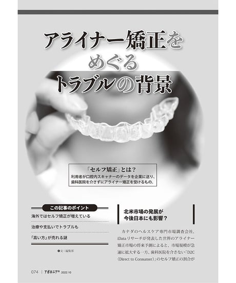 月刊アポロニア21【2022年10月号】アライナー矯正の経営論 ―最新トレンドとリスク対応