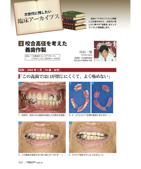 月刊アポロニア21【2022年10月号】アライナー矯正の経営論 ―最新トレンドとリスク対応