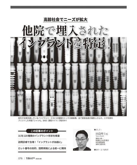 月刊アポロニア21【2023年8月号】ピンチ・失敗に学ぼう！［臨床編］ ー外科手術、認知症、アライナー矯正