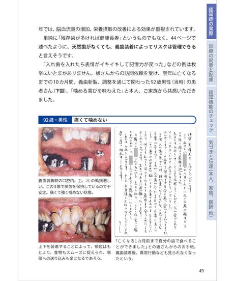 認知症グレーゾーンの歯科診療と地域連携Q&A